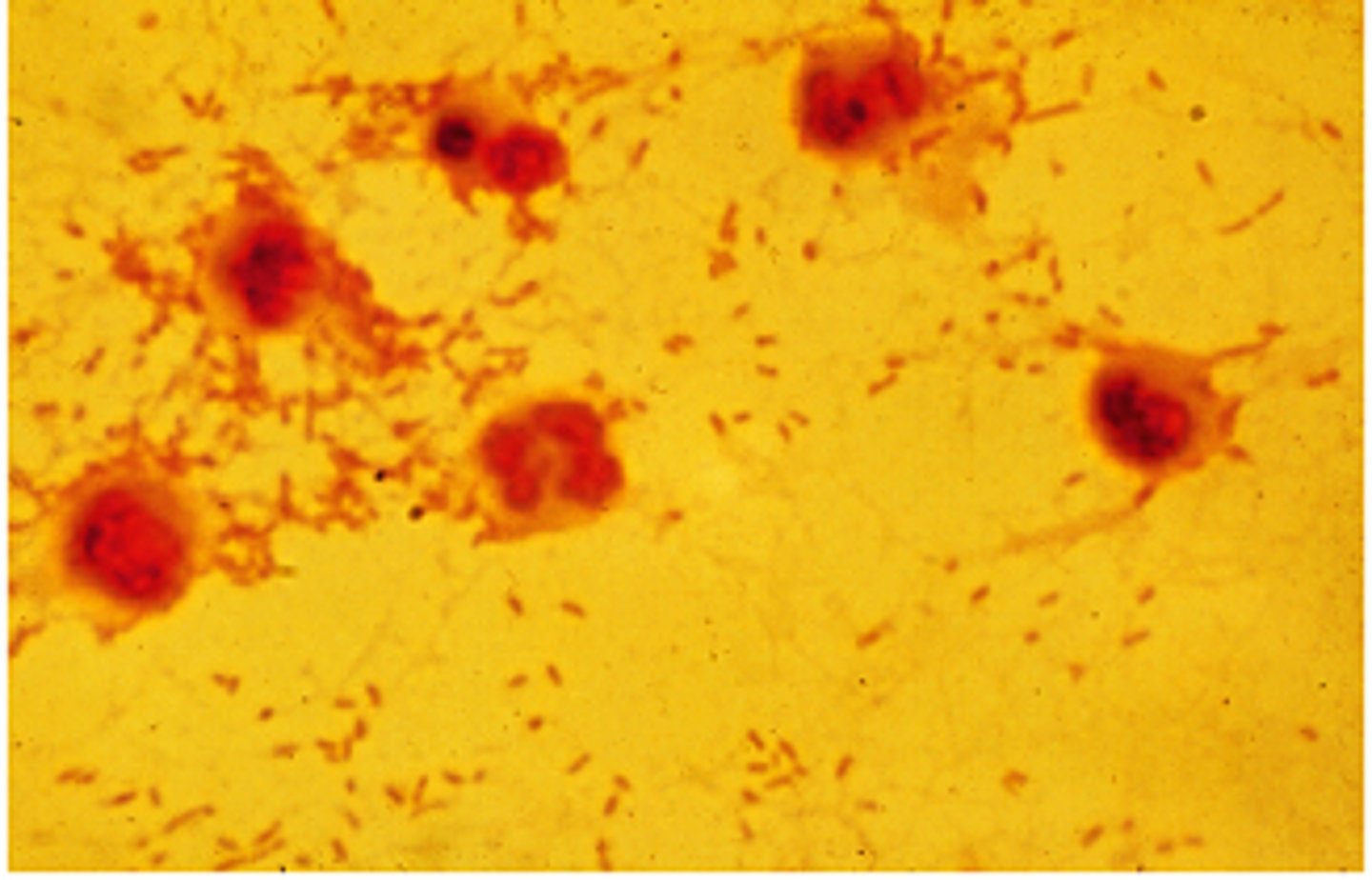 <p>Listeria</p>