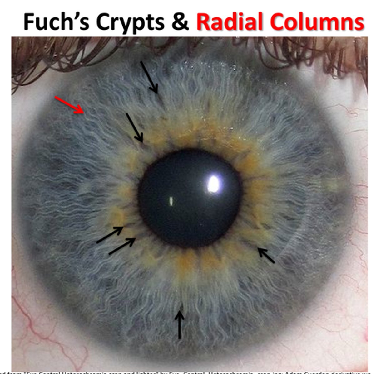 <p>radial blood vessels encased within collagen in ciliary zone from major arterial circle → minor arterial circle</p><p>Collagen prevents kinking during dilation</p>
