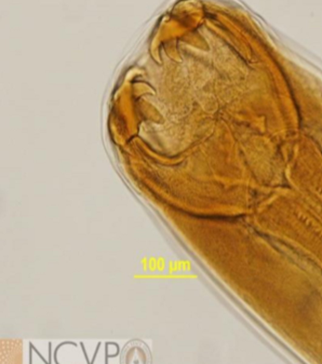 <p>Hookworms</p><p>3 pairs of teeth</p>
