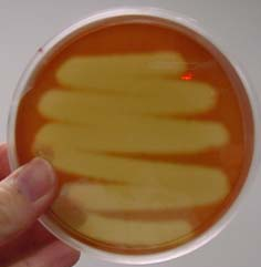 <p>What type of hemolysis is this?</p>