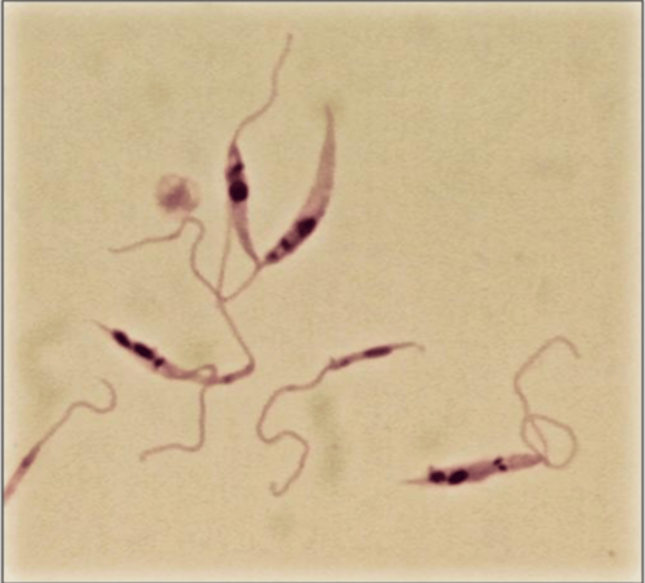 <p>These were found in a dog with severe emaciation and alopecia who had travelled to France within the last 6 months. What parasite is this?</p>