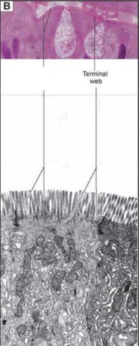<p>What apical surface projection is this?</p>