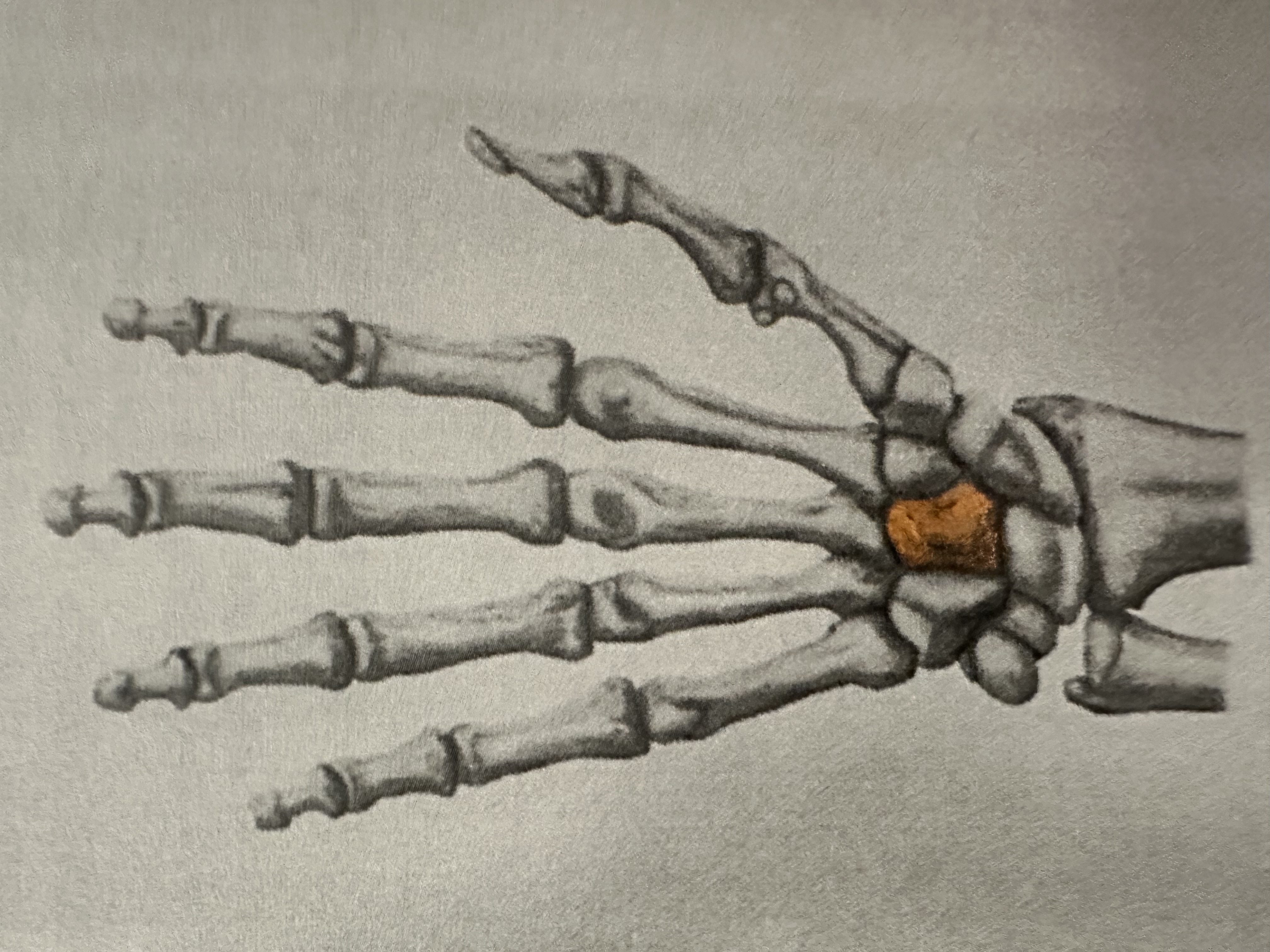 <p>Distal Carpal Bone</p><p>( Here Comes The Thumb)</p>