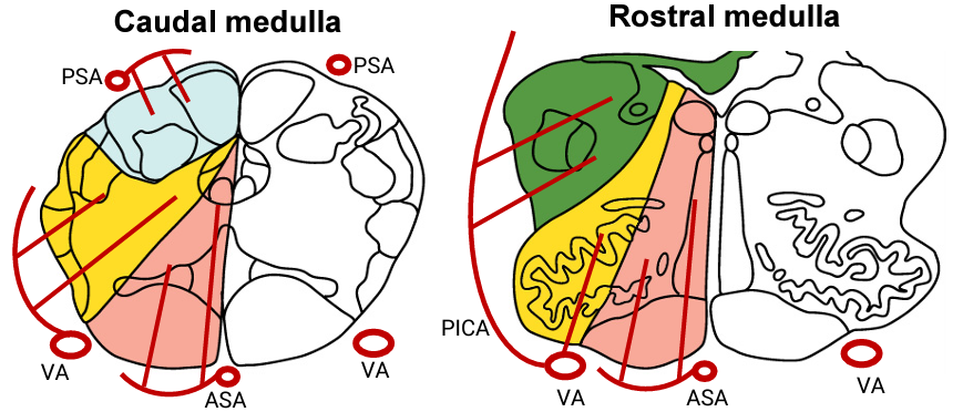 <p><strong>Lateral </strong>aspect of the <strong>medulla</strong></p>