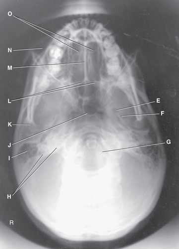 <p>Which of the following represents the mandibular condyles:</p><p>G H F K E L</p>