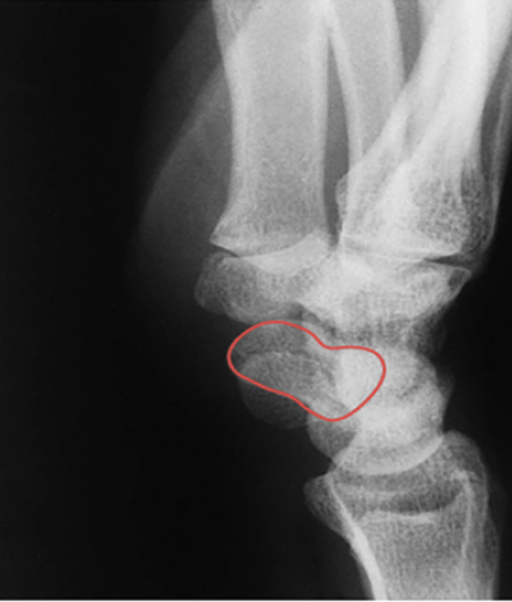 <p>What structure is highlighted?</p>