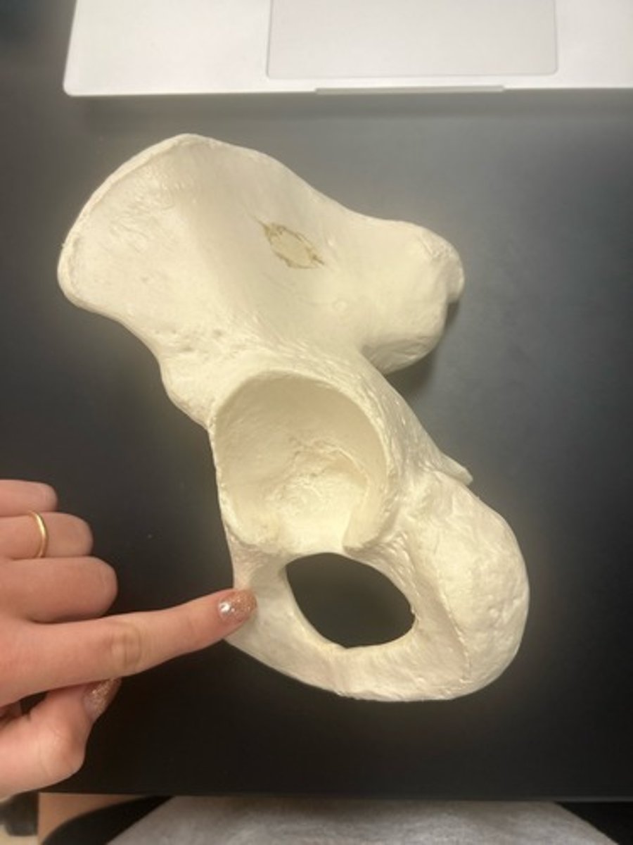 <p>name the bone</p>