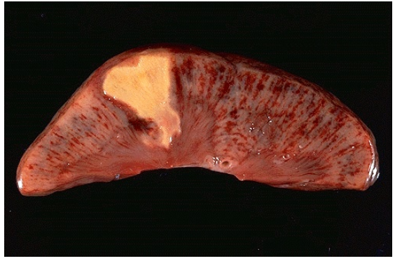 <ol><li><p>Identify the type of cell death and CD</p></li></ol><p></p>