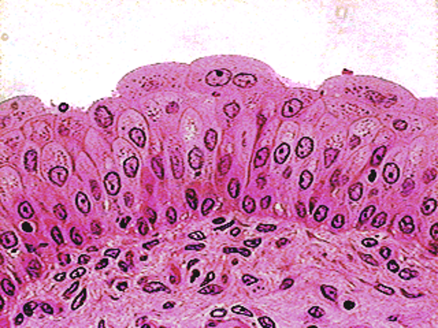 <p>type of epithelium that can stretch; bladder ureters, urethra</p>