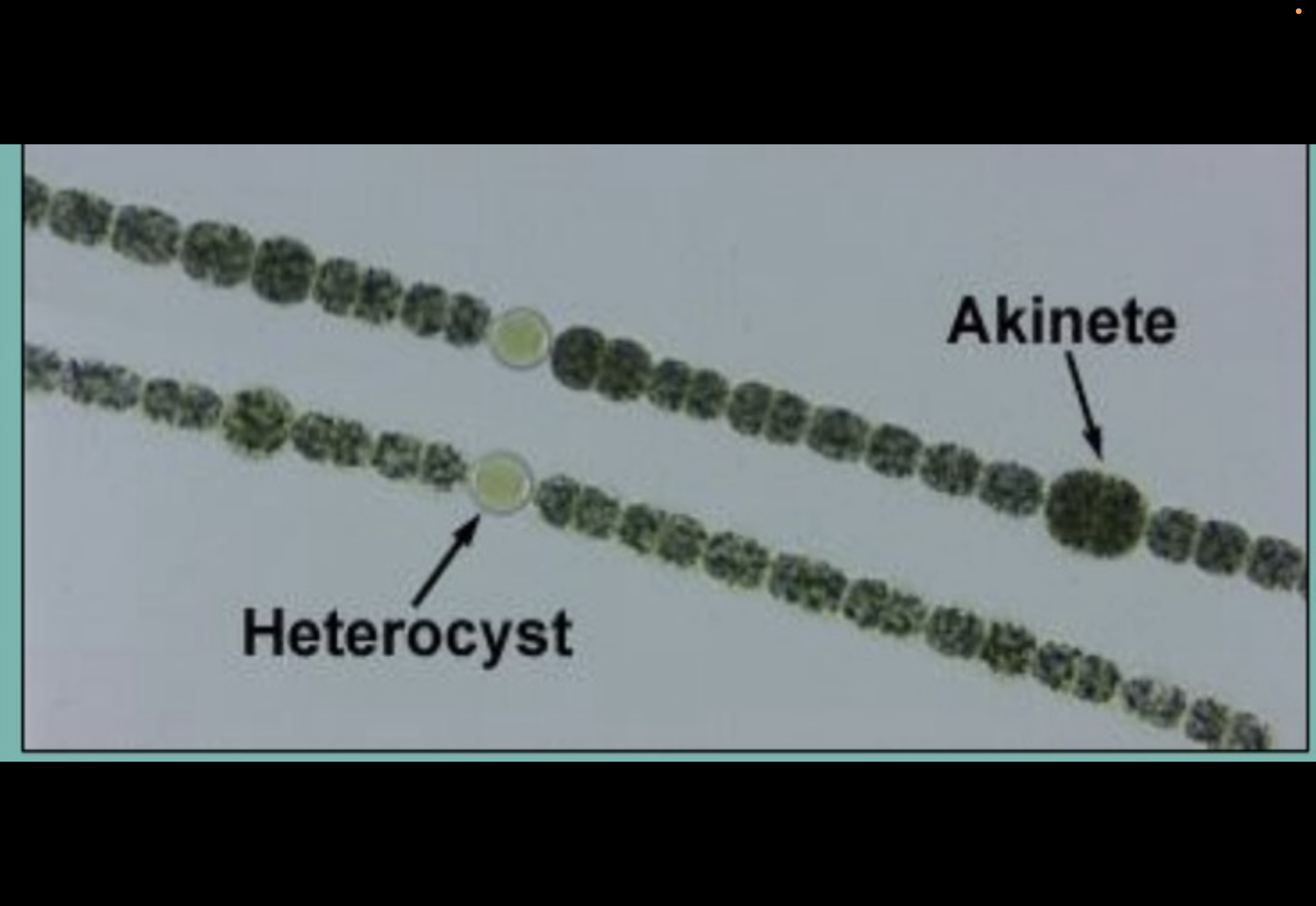 <p>Heterocyst and akinete</p>