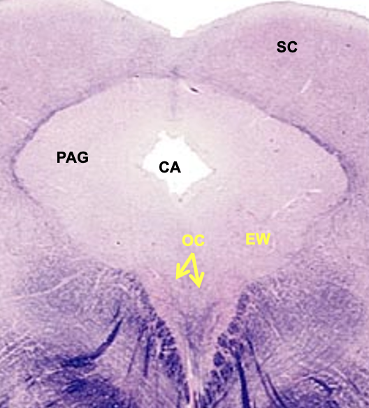 <p>CN3; somatic motor - neurons here give rise to axons in oculomotor nerve that innervate eye muscles&nbsp;</p>