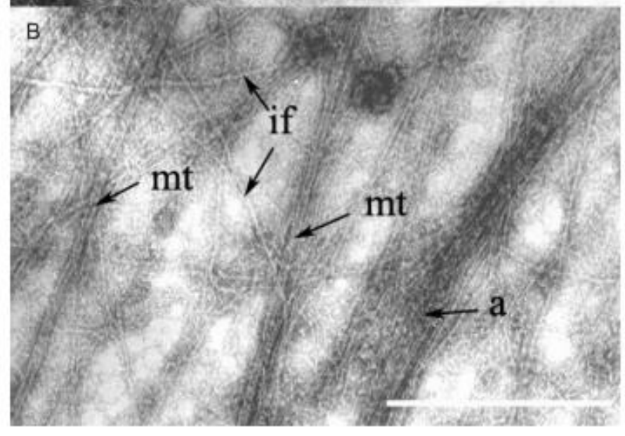 On distingue 3 constituants du cytosquelette: 
--> filaments d'actine
--> microtubules 
-->filaments intermédiaires 
