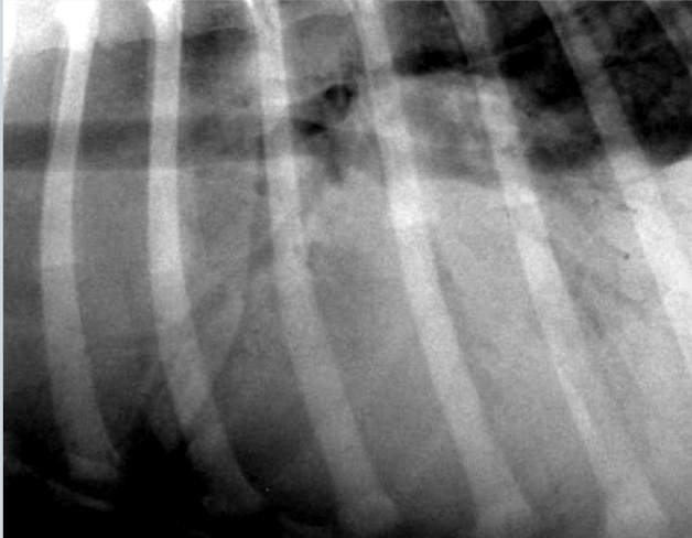 <p>What alveolar pattern? How do you know? </p>