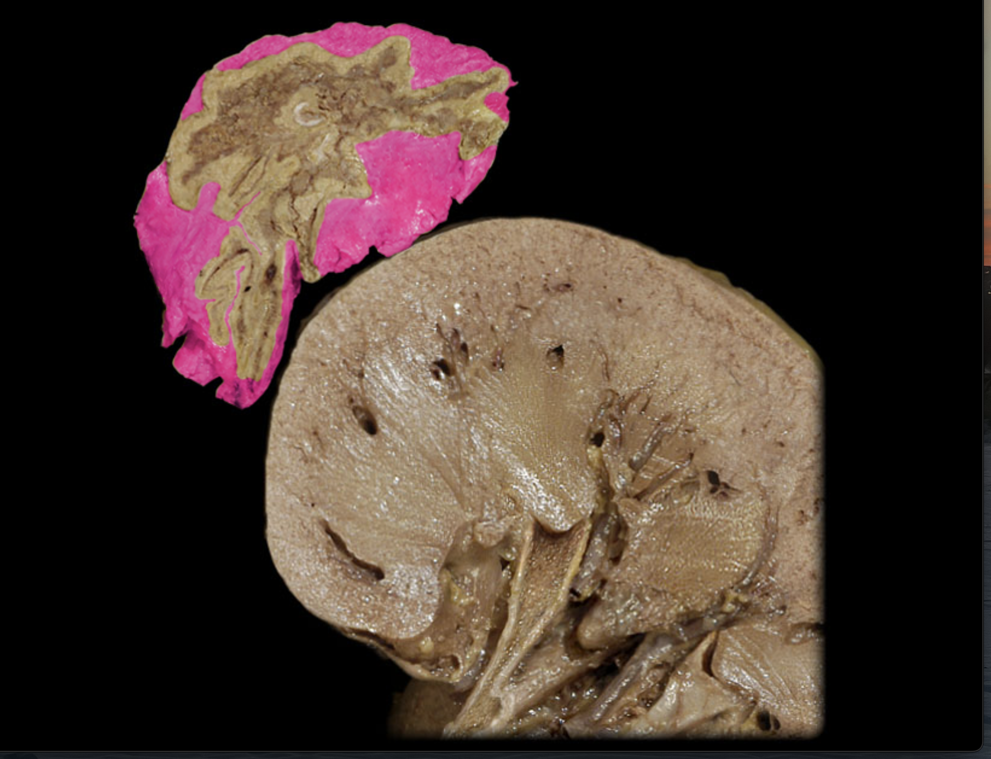 <p>Outer layer surrounding kidney</p>