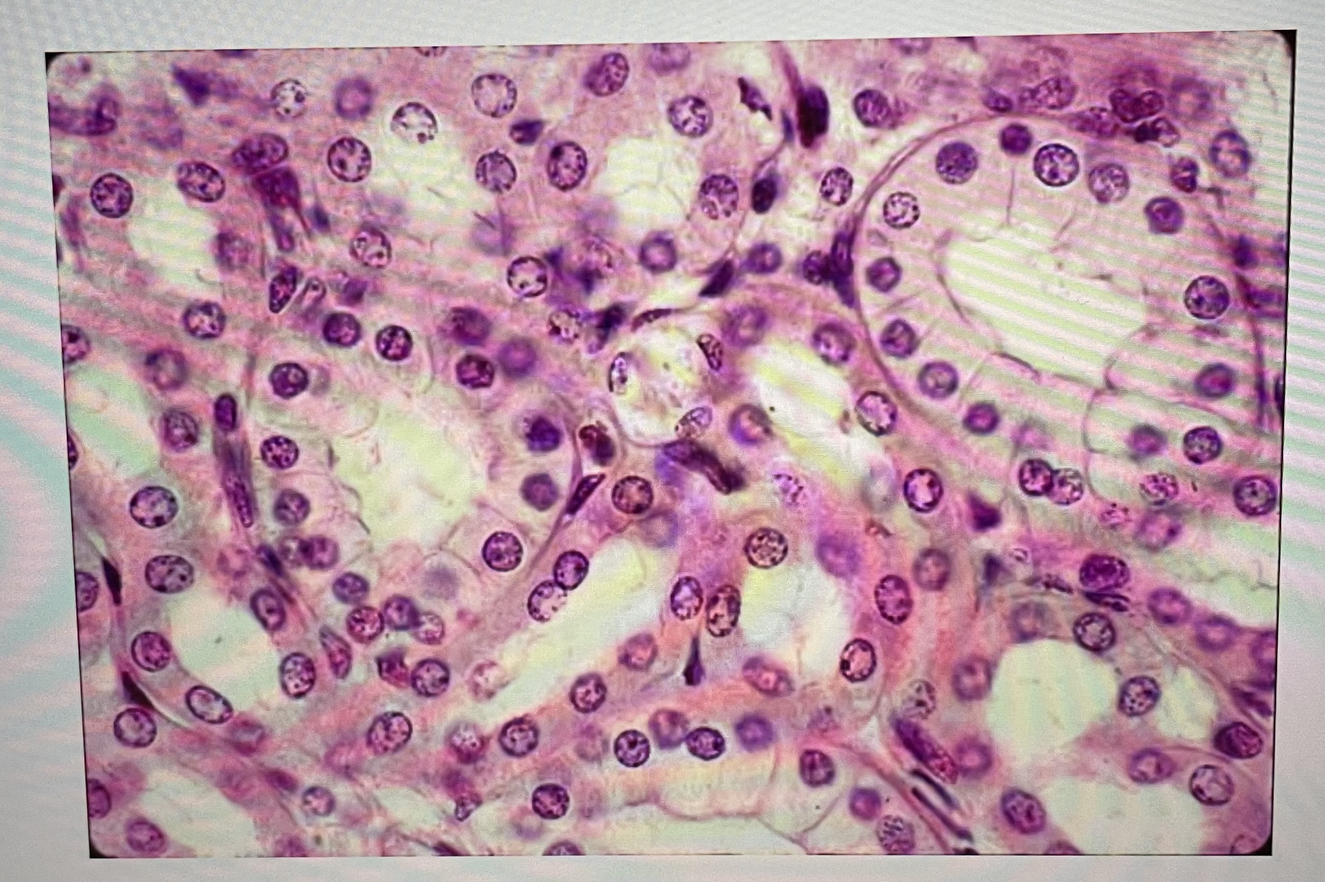 The cells seen here in a microscope slide of a kidney tubule is an example of a