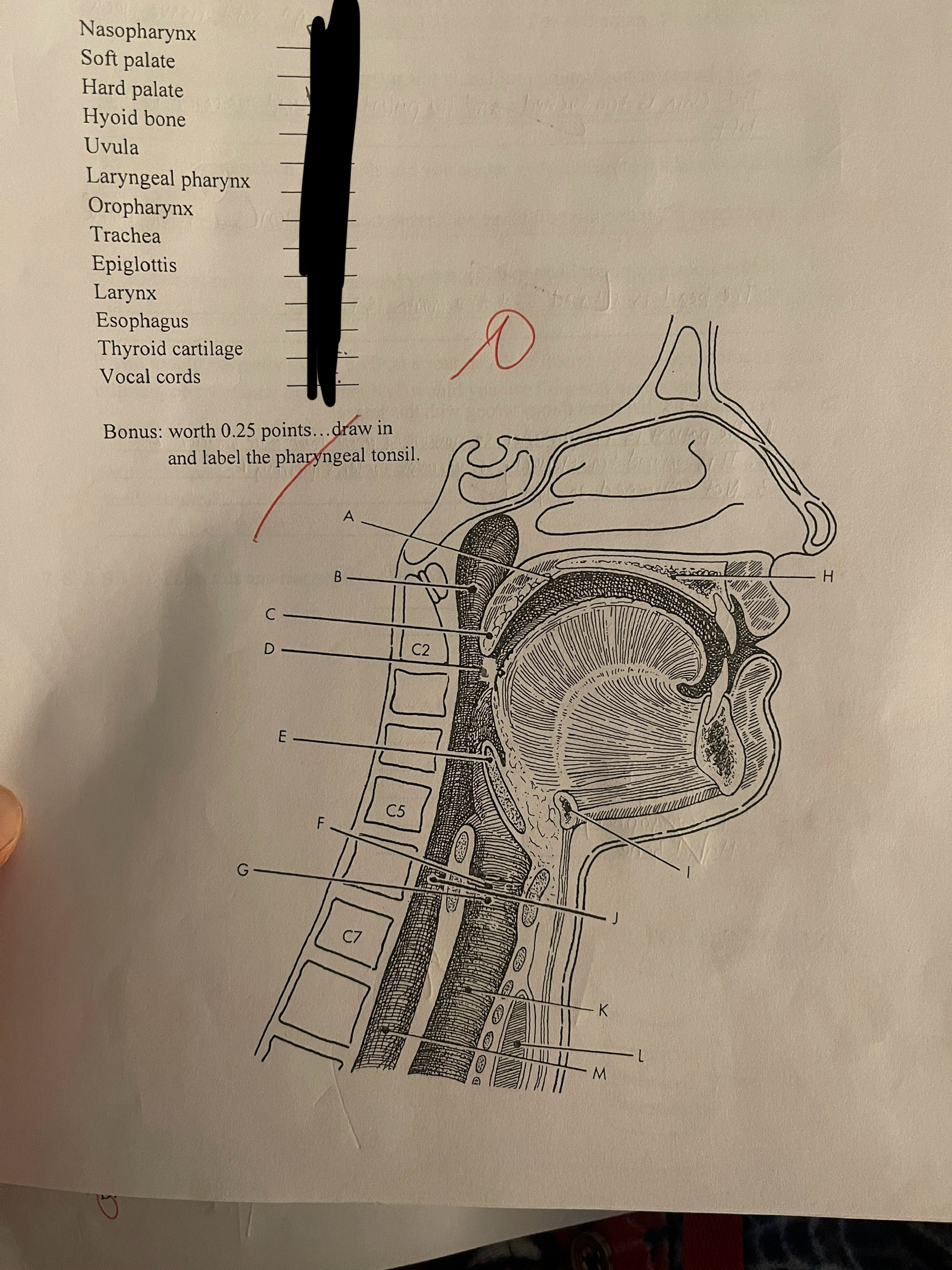 <p>Match the following anatomy to its correct location on this lateral view of the soft tissue structures of the anterior neck</p>