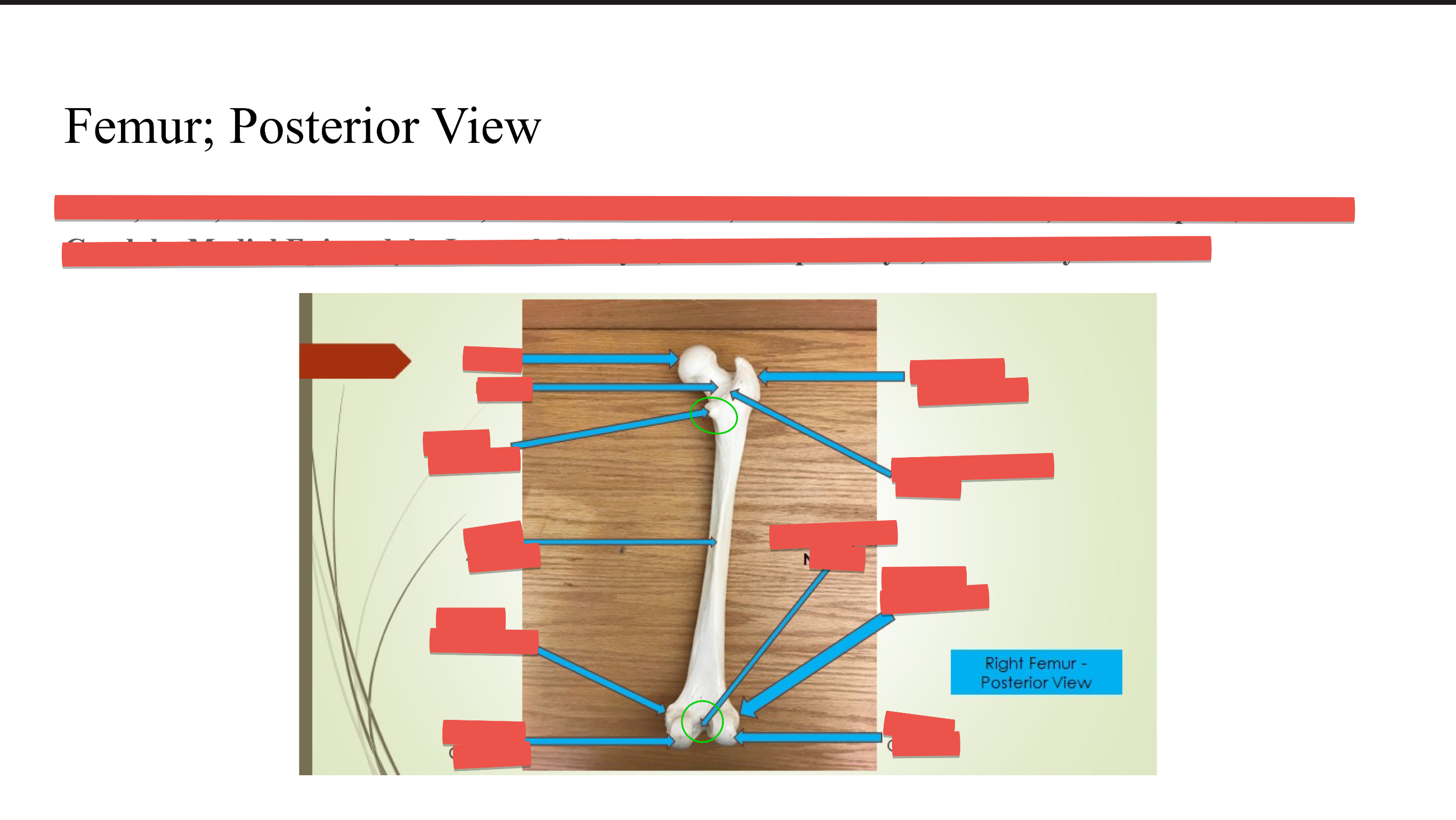 <p>Intercondylar Notch</p>