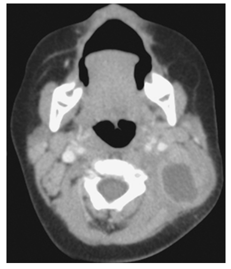 <p>What does the figure show?</p>