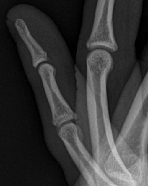 <p>Describe the abnormality demonstrated. </p>