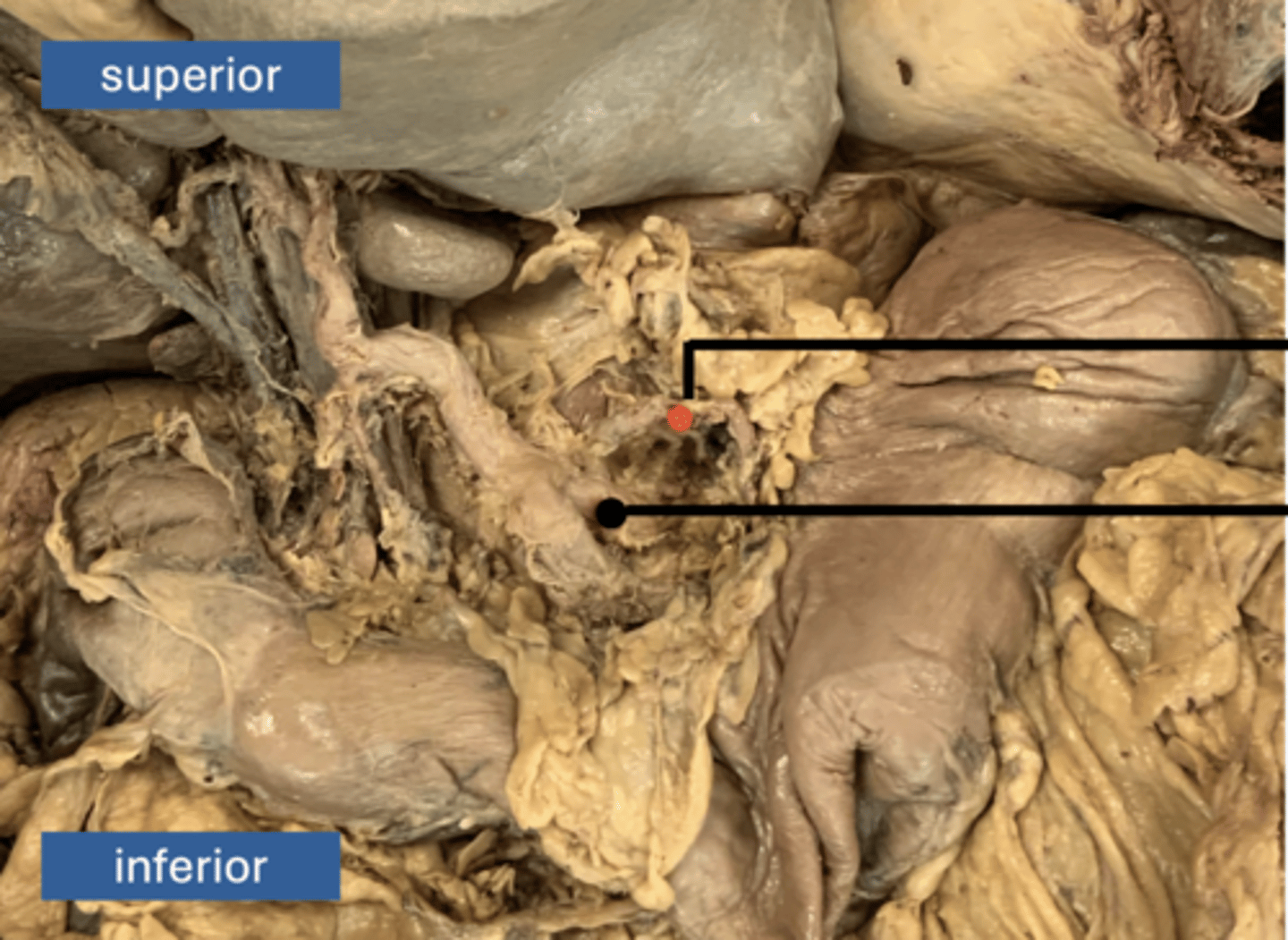 <p>artery</p>