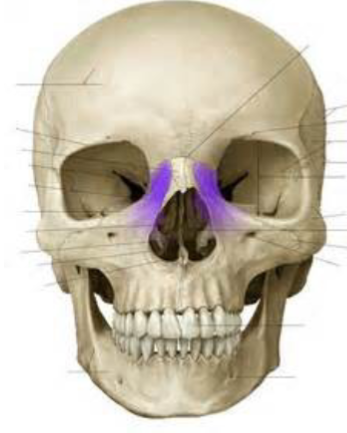 <p>Which maxilla bone marking is this? (2)</p>