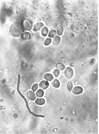 term image