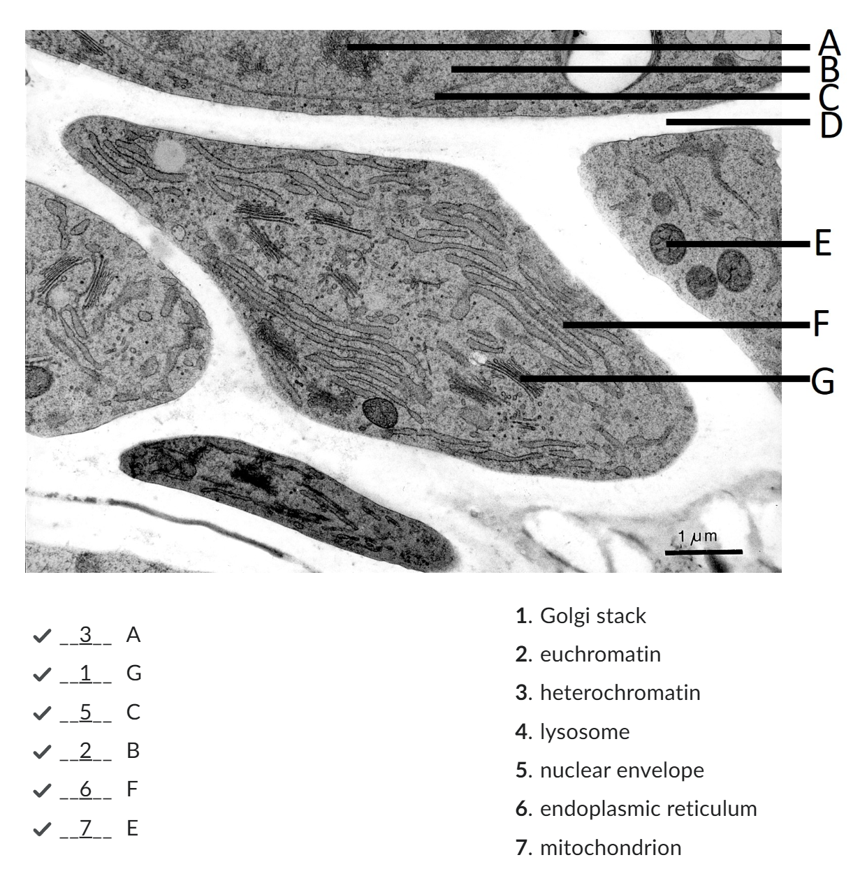 <ul><li><p><strong>chromatin fibers met transcriptionally active genes, met wider spaces between the nucleosomes (DNA + histone protein = repeating units of chromatin structure);</strong></p></li><li><p><strong>Euchromatin</strong> constitutes the chromatin structure associated met the active transcription of genes.</p></li></ul><p></p>