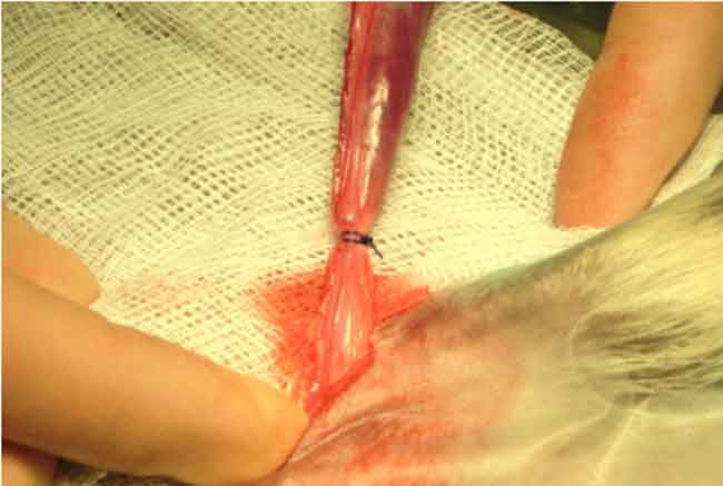 <p>nylon, wire, or catgut tied around structure to prevent bleeding</p>