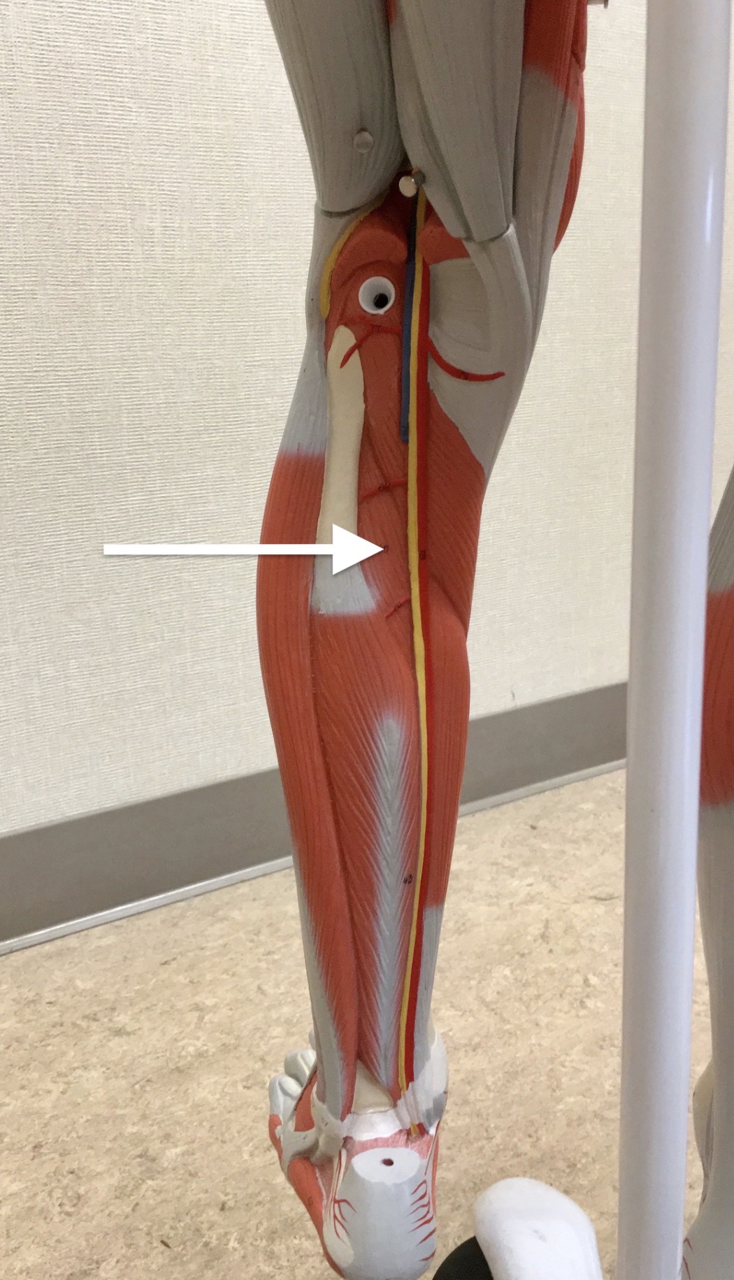 <p><span>Name the muscle labeled with the white arrow below:</span></p>