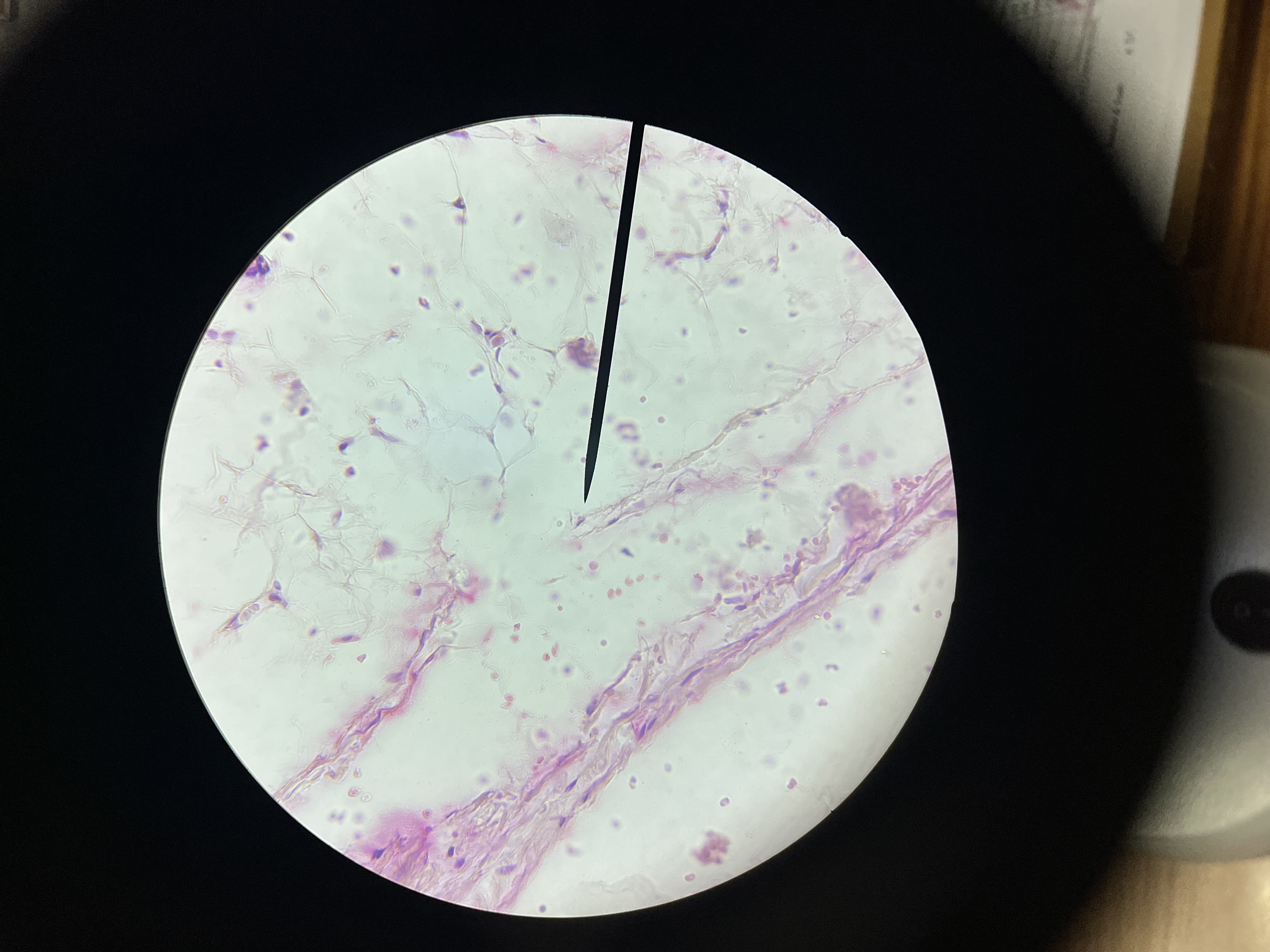 <p>What is the diagnosis?</p>