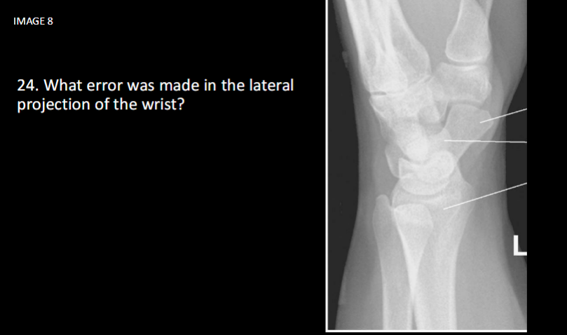 <p>What error was made in this lateral projection of the wrist</p>