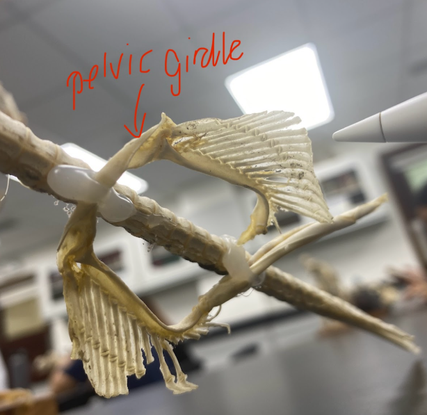 <p>Other view for pelvic girdle</p>