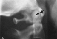 <p>Q what is the name of this measurement? and what is the average + range?</p>