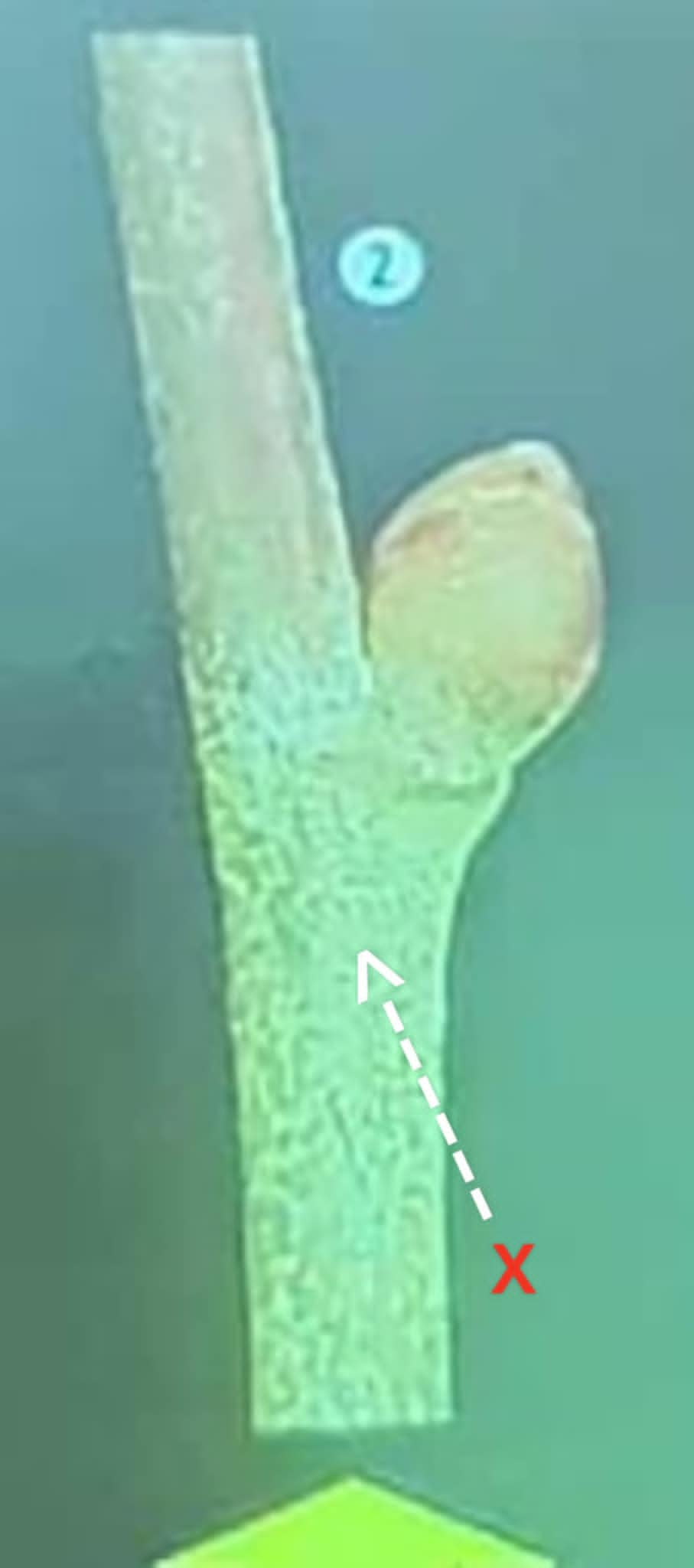 term image