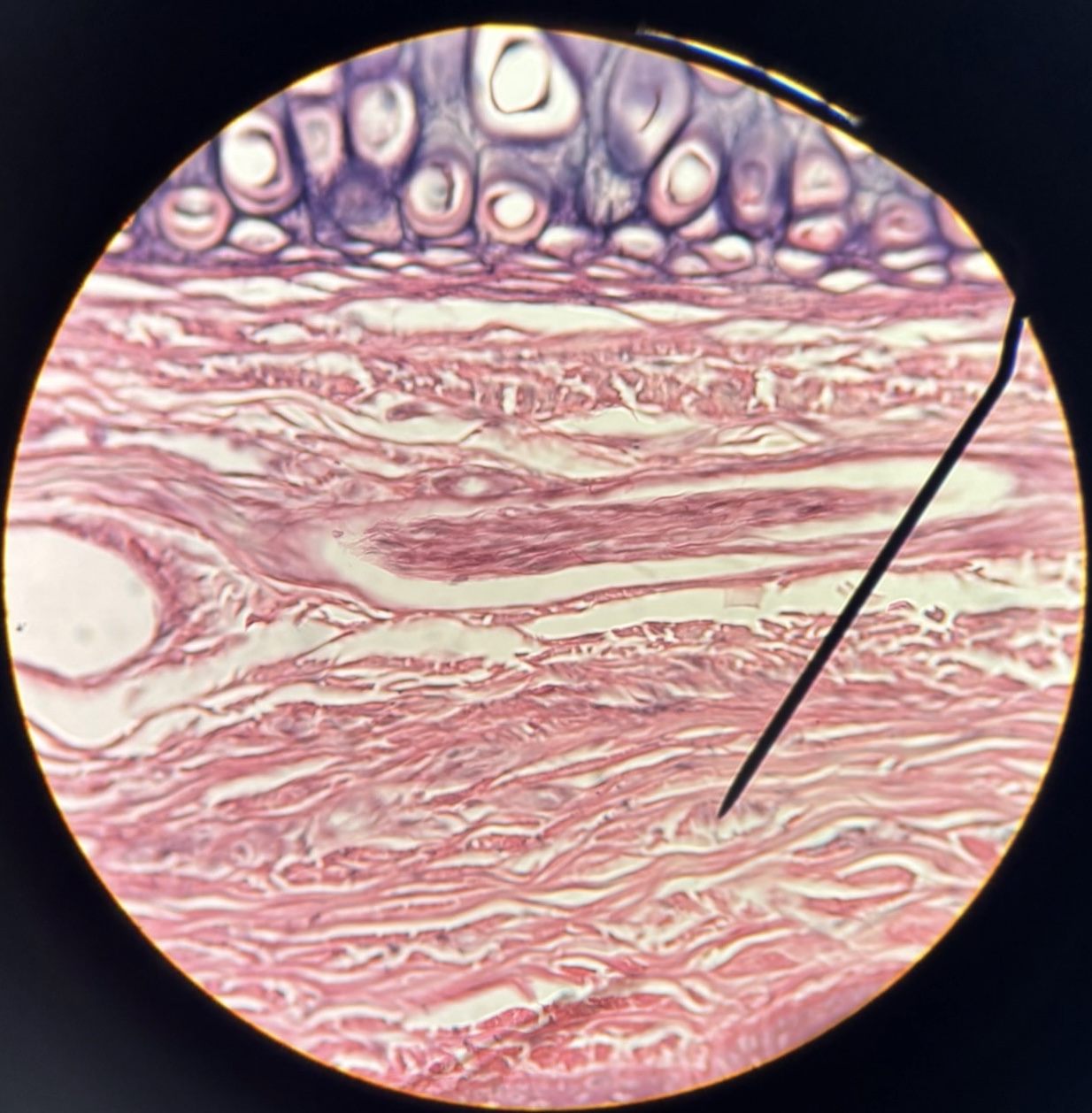 term image