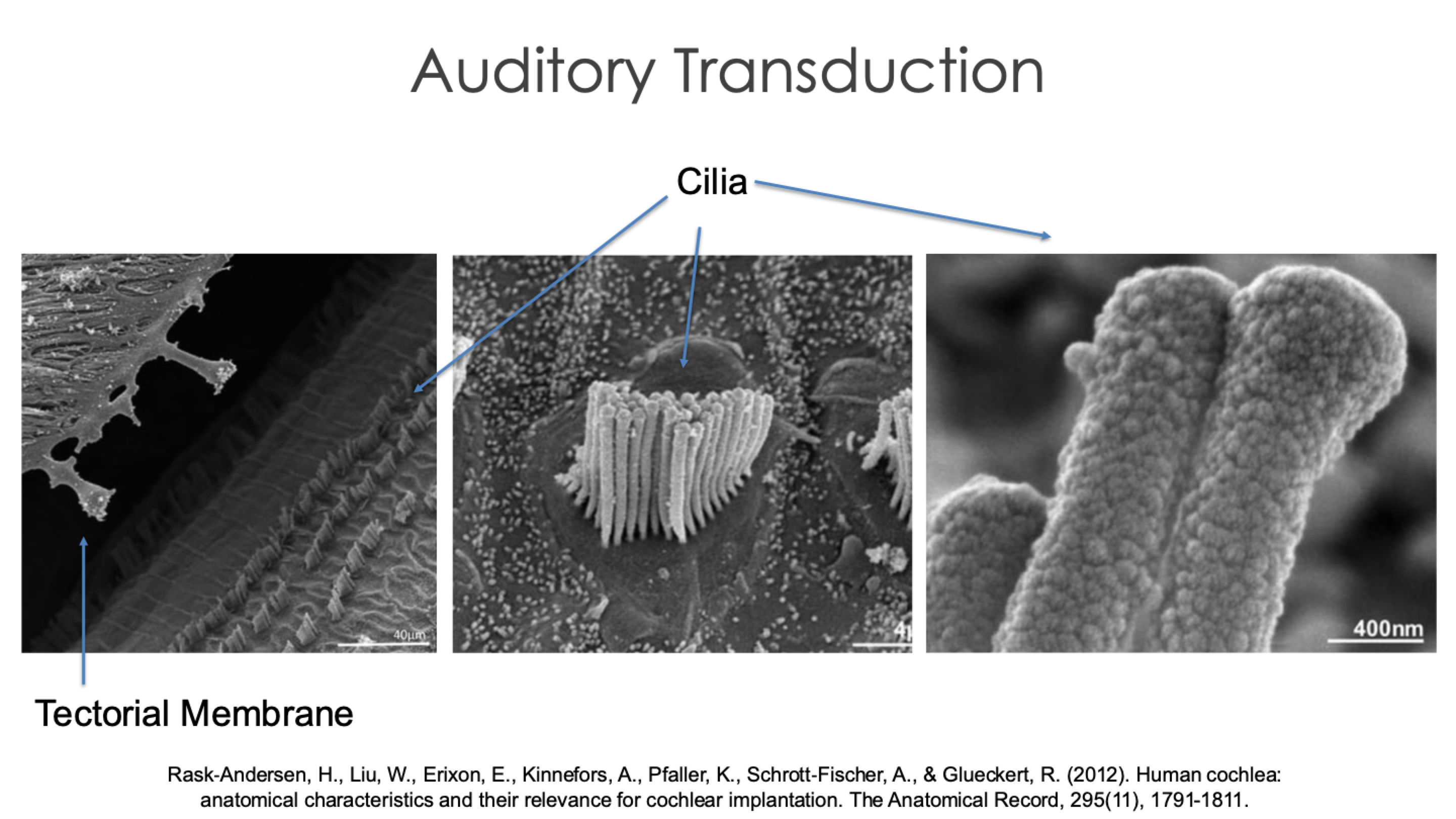 <ul><li><p>Not all cilia are the same height</p></li></ul><ul><li><p>They move back and forth by vibration</p></li></ul><p></p>