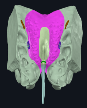 term image