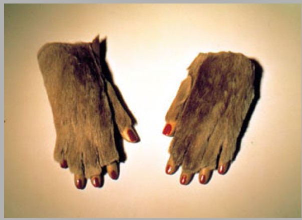 term image