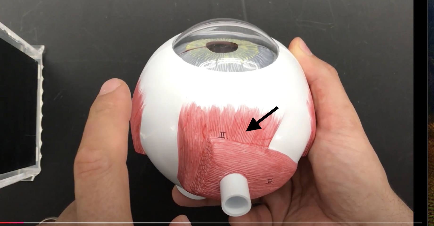 <p>What muscle is this?*****</p>