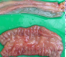<p>in discrete sheets, poorly demarcated and widespread distribution</p><p>Ex: Paratuberculosis</p><p>Johne’s disease</p>
