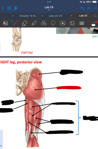 <p>What muscle is this?</p>