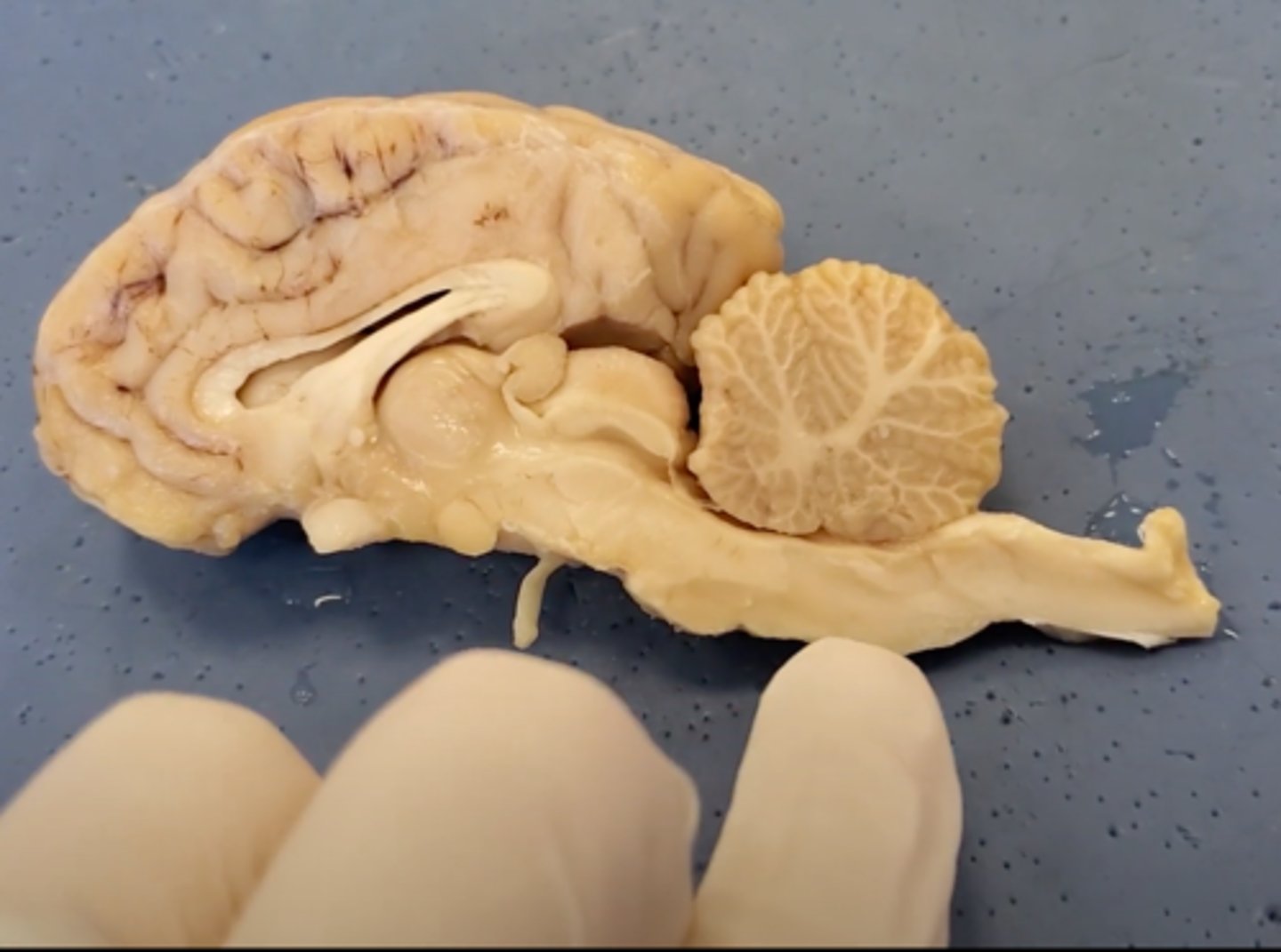 <p>part of the brain that controls breathing, heartbeat, and the size of blood vessels</p>