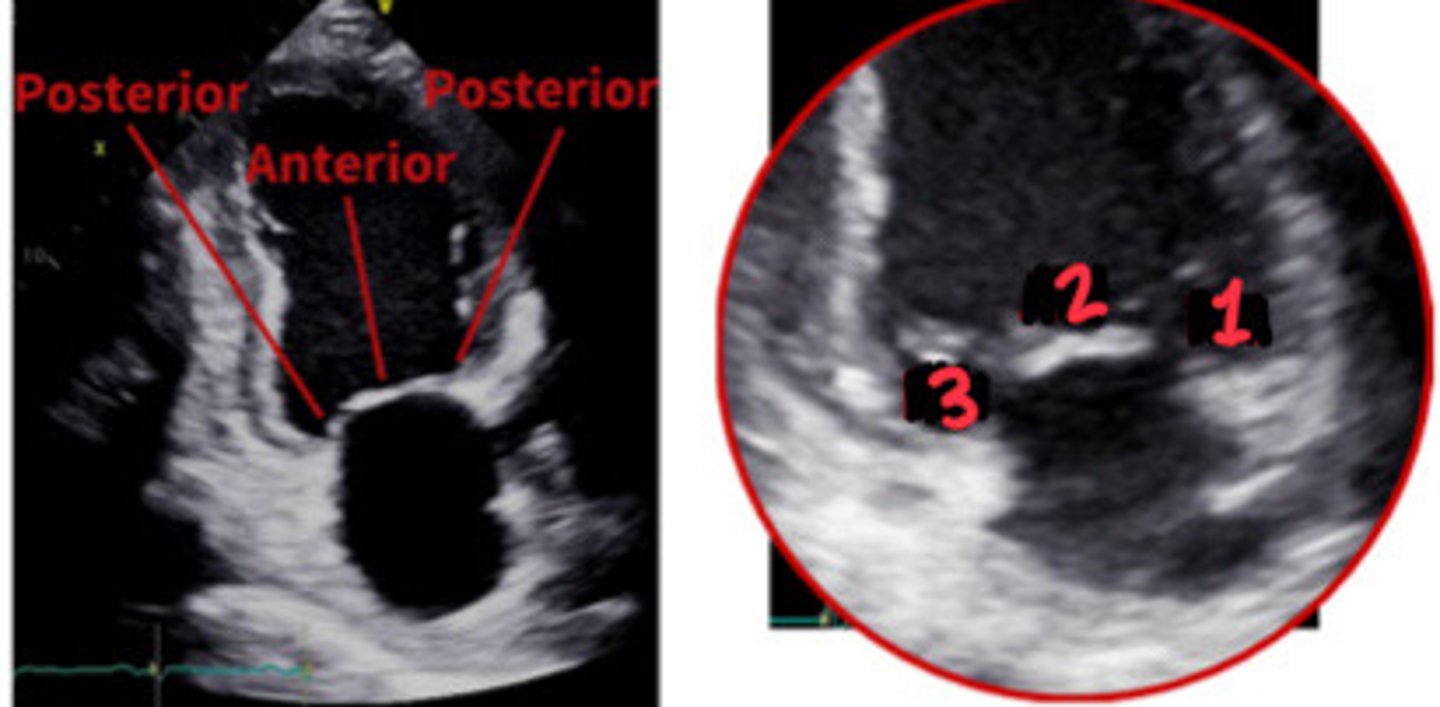 <p>What section of the MV is 1</p>