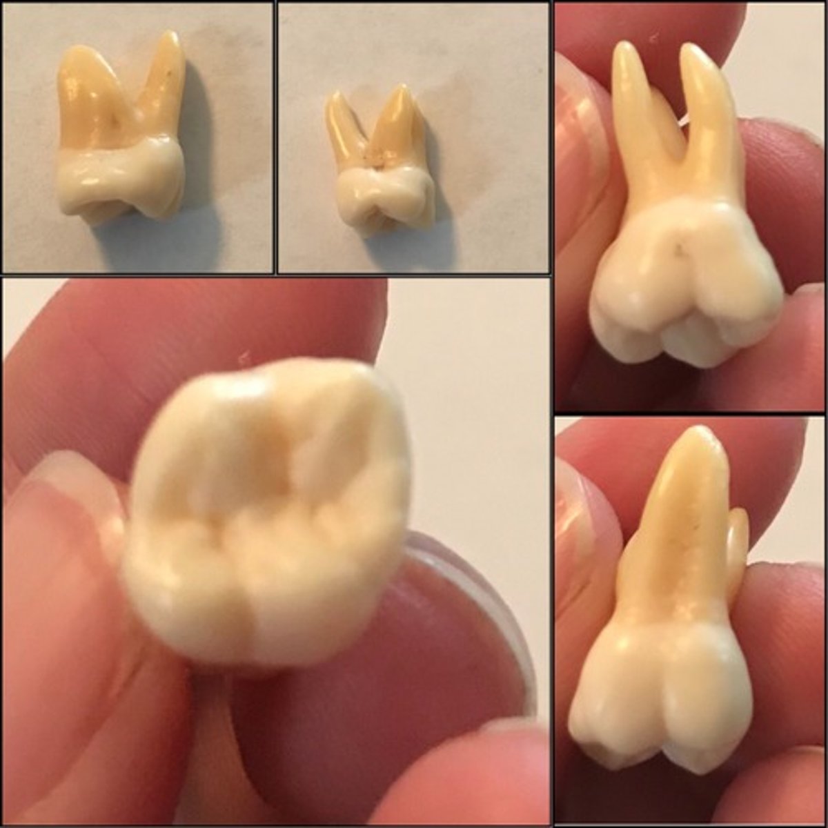 <p>What tooth is this ?</p>