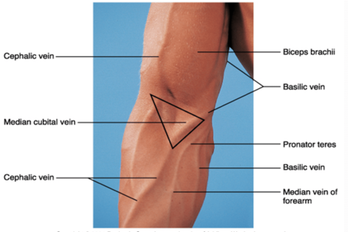 <p>extensors (brachioradialis m.)</p>