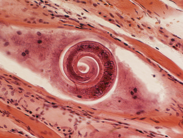 <p><span>This parasite encysts in muscle tissue and is nonpathogenic to its porky host. What is it?</span></p>