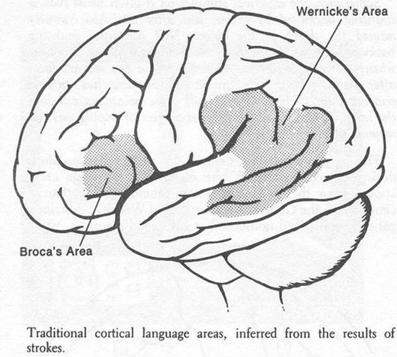 <p>Wernicke area</p>