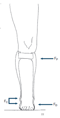 <p>What moment is this 3-point pressure system creating at the ankle?</p>