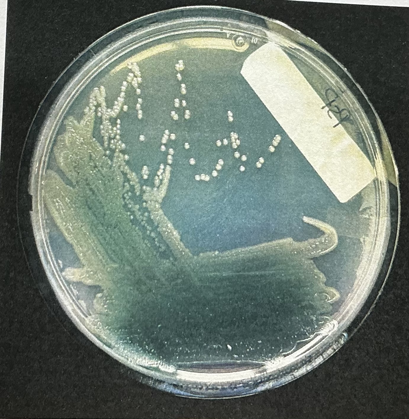 <p>Produced by Pseudomonas aeruginosa</p>