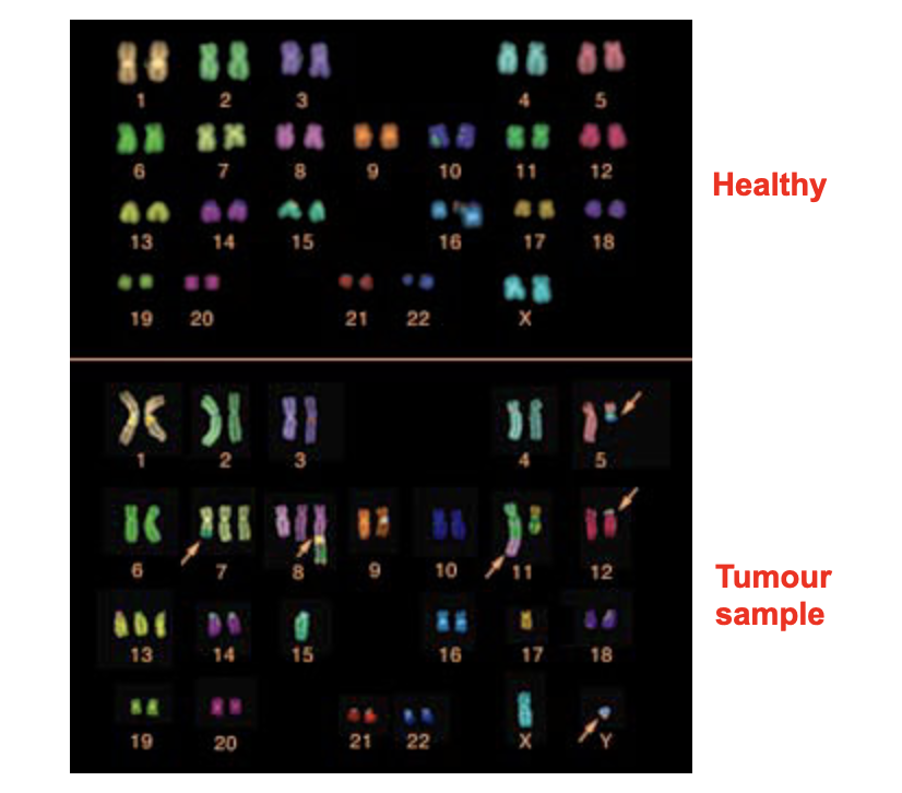 <ul><li><p class="Paragraph SCXO126963512 BCX4" style="text-align: left;"><span style="background-color: inherit; line-height: 19.55px; color: windowtext;"><span>Uses a large cocktail of probes that will bind to many different locations along the length of a single type of chromosome</span></span><span style="line-height: 19.55px; color: windowtext;"><span>&nbsp;</span></span></p></li><li><p class="Paragraph SCXO126963512 BCX4" style="text-align: left;"><span style="background-color: inherit; line-height: 19.55px; color: windowtext;"><span>Spectral karyotyping (SKY) can allow for the entire set of chromosomes to be analysed</span></span><span style="line-height: 19.55px; color: windowtext;"><span>&nbsp;</span></span></p></li></ul><p></p>
